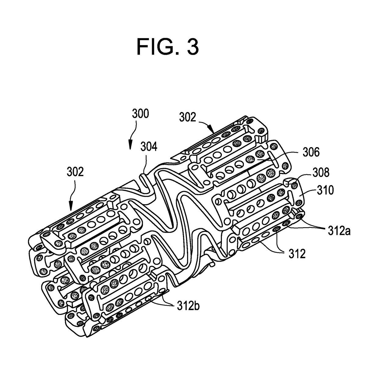 Bare metal stent with drug eluting reservoirs having improved drug retention