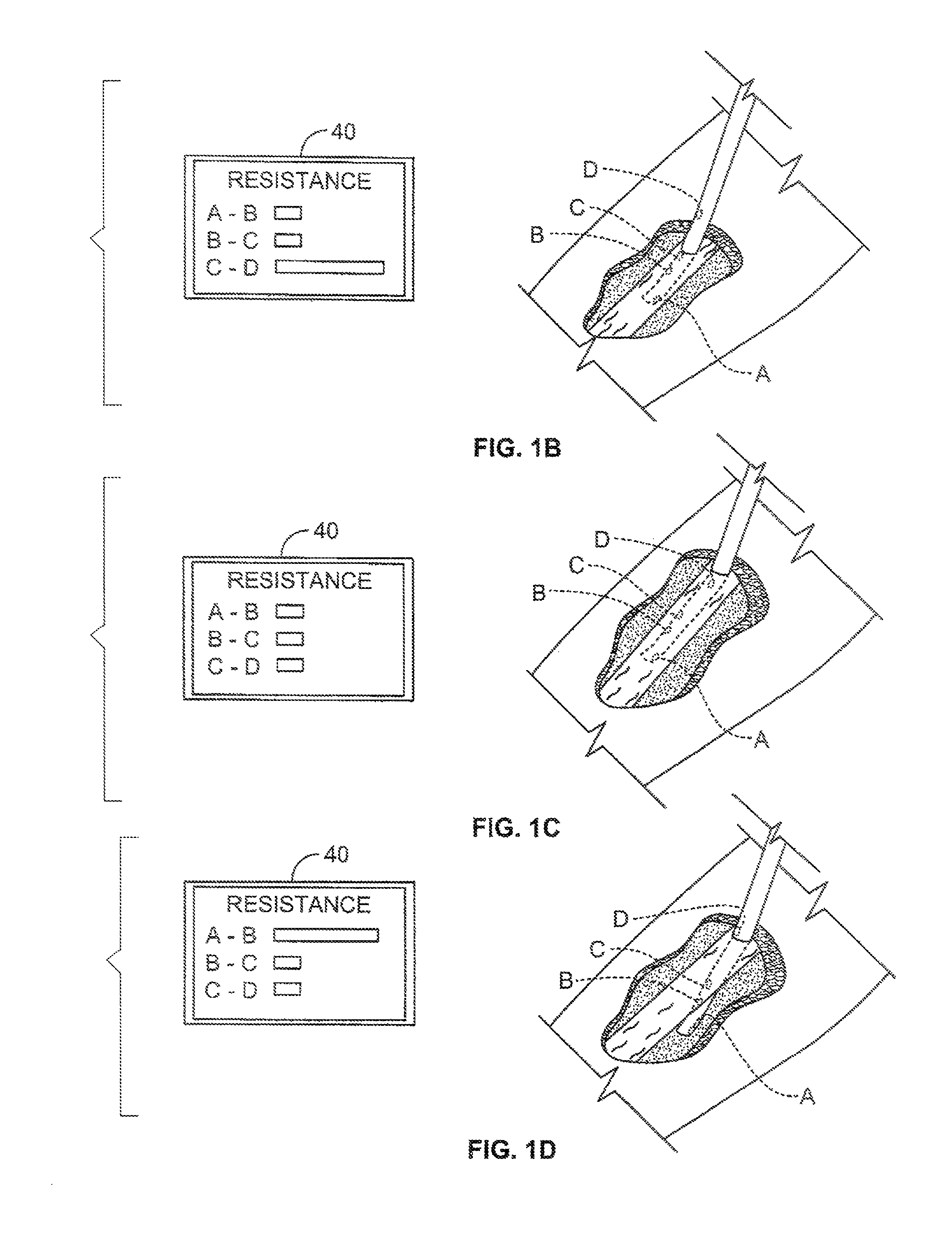 Apparatus and method for monitoring catheter insertion