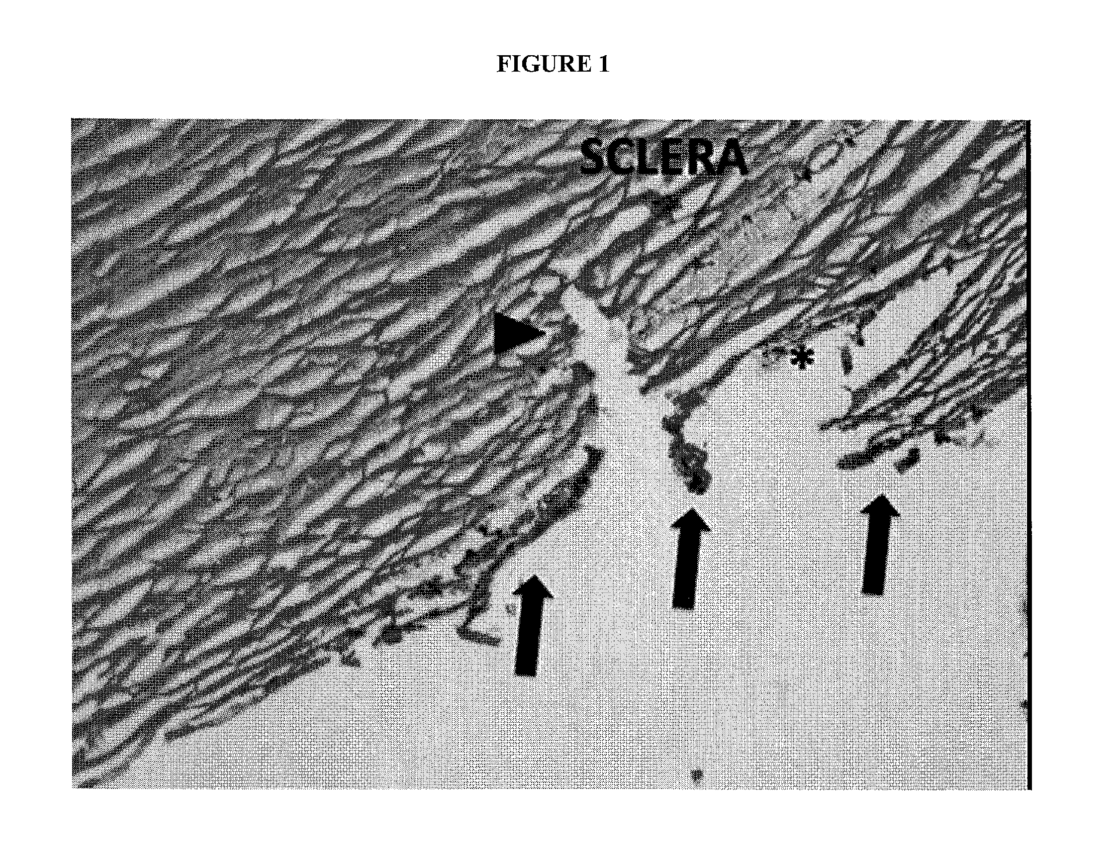 Modified dual-blade cutting system