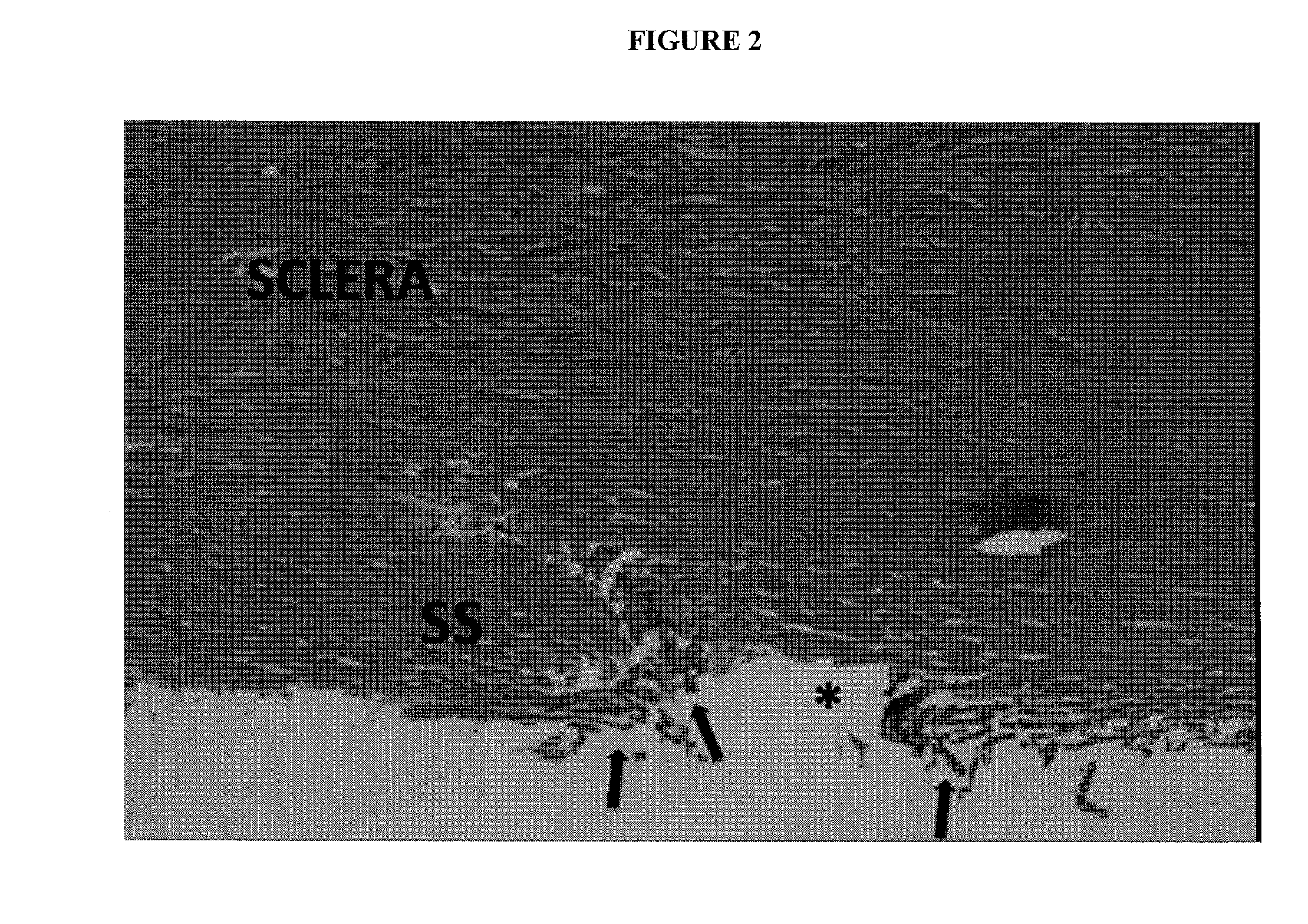 Modified dual-blade cutting system