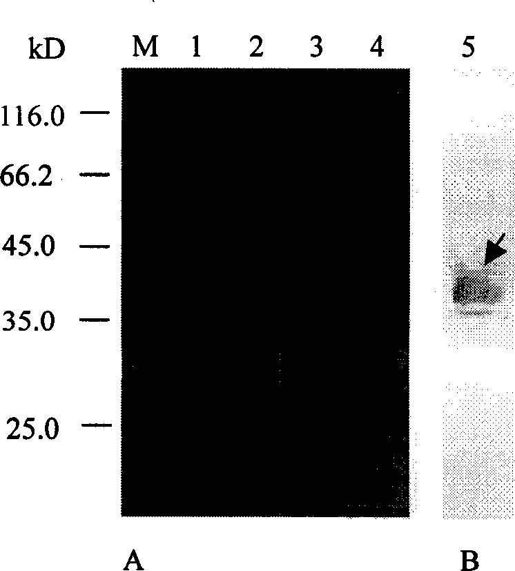 Recombined aquatic bird flu virus H5 subtype hemagglutinin, its preparation method and uses