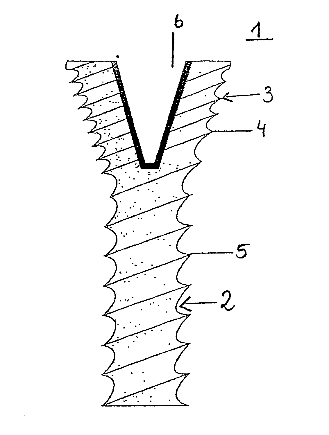 Bone screw