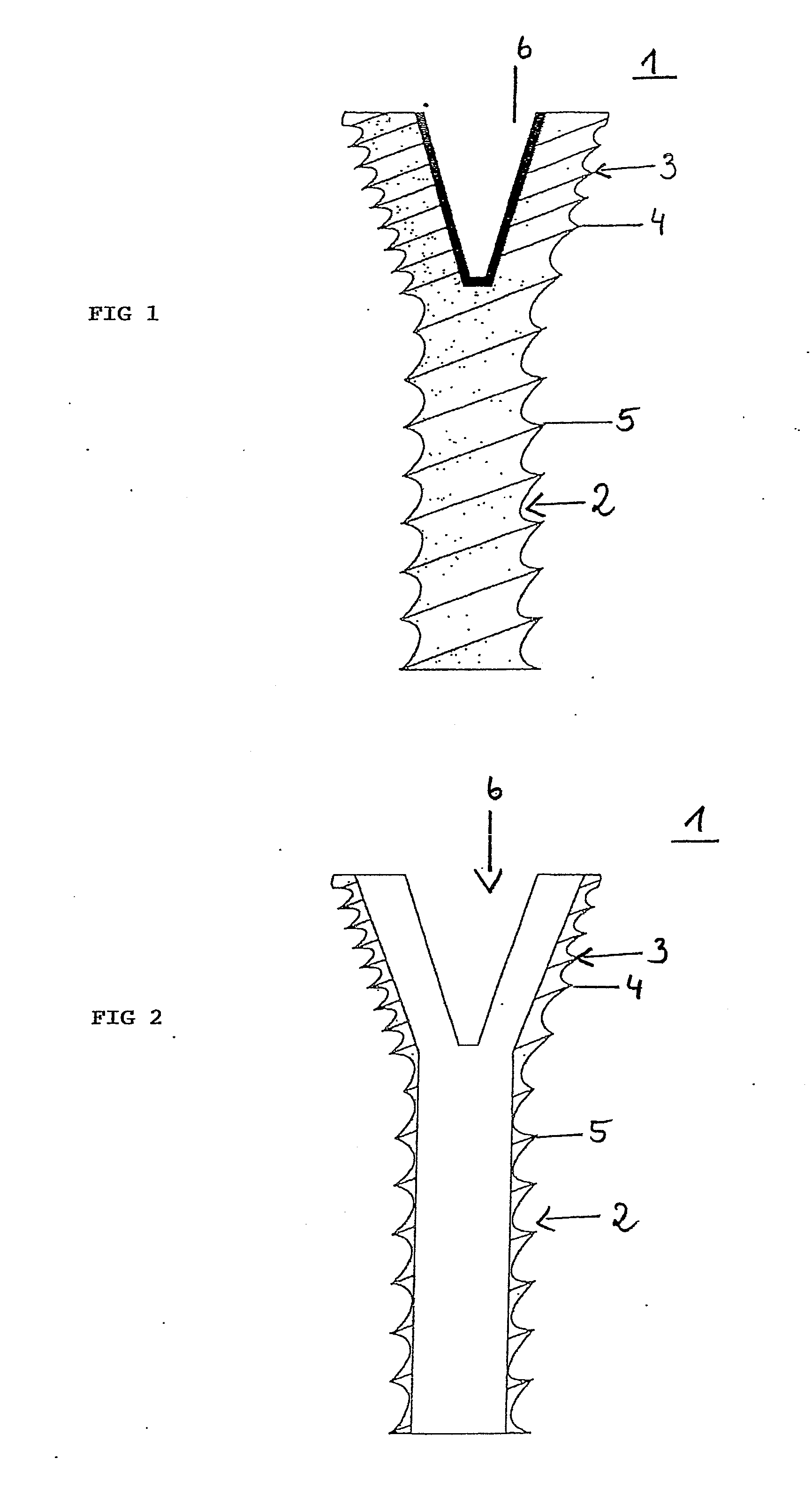 Bone screw