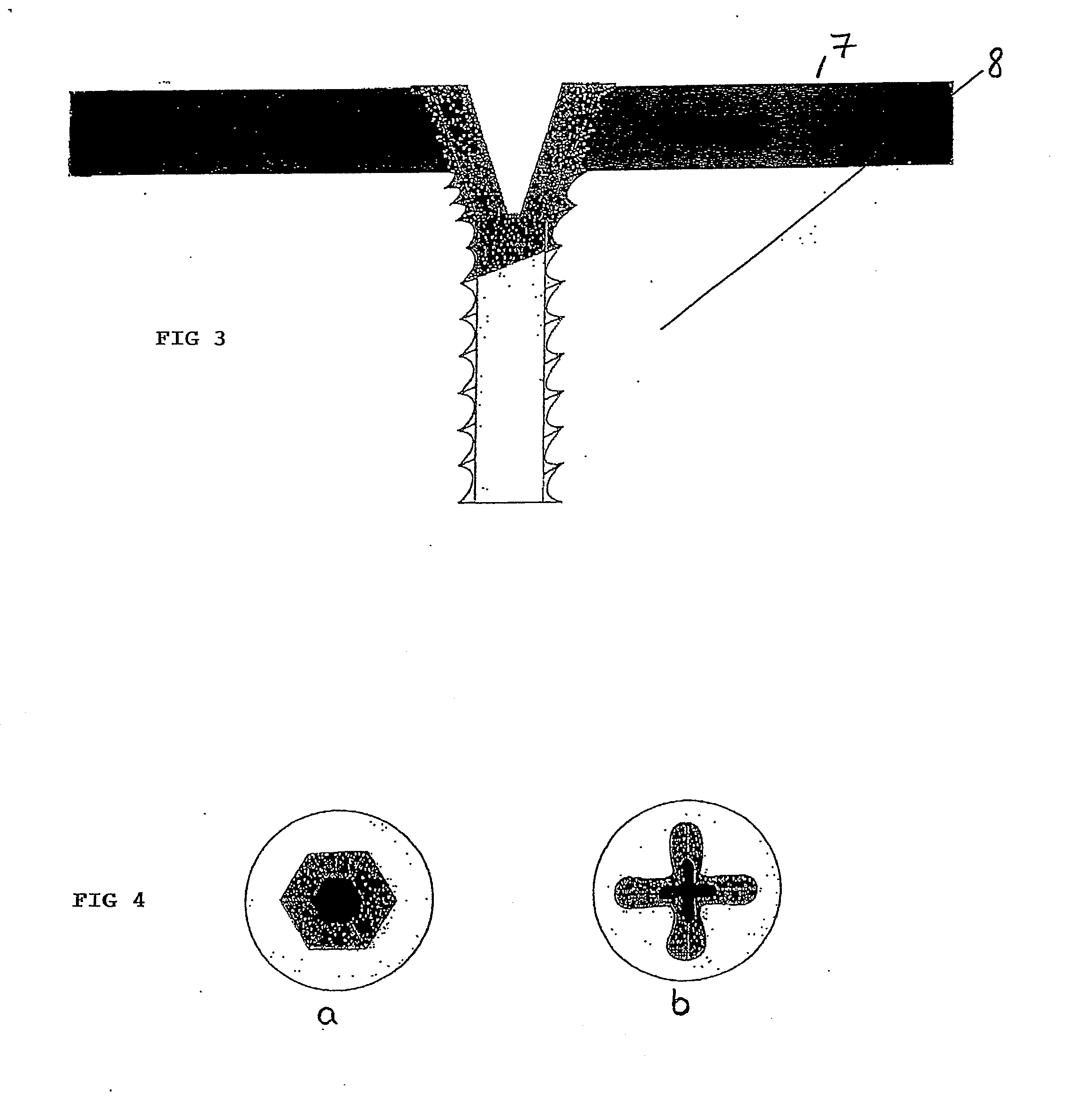 Bone screw