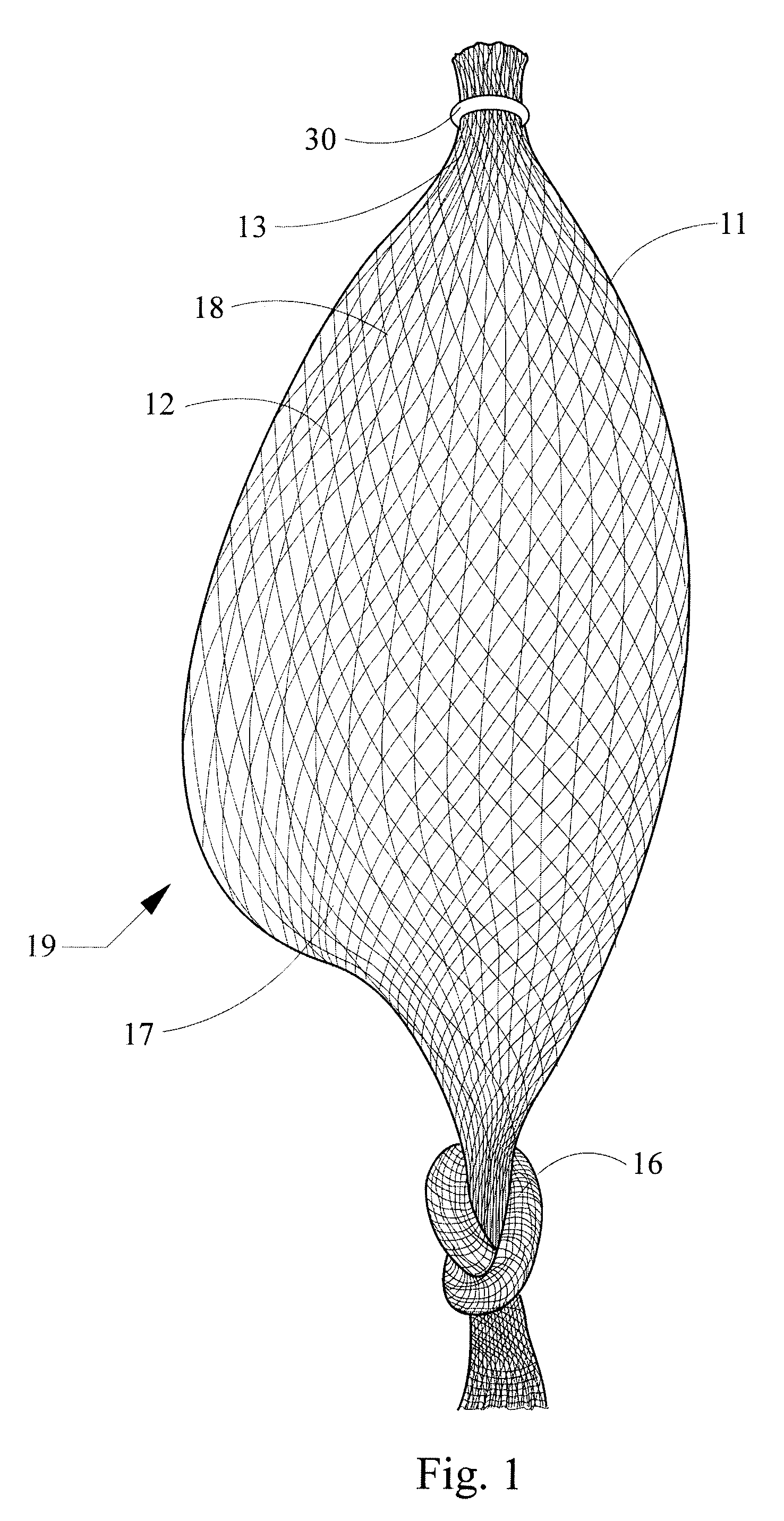 Intragastric bag apparatus and method of delivery for treating obesity