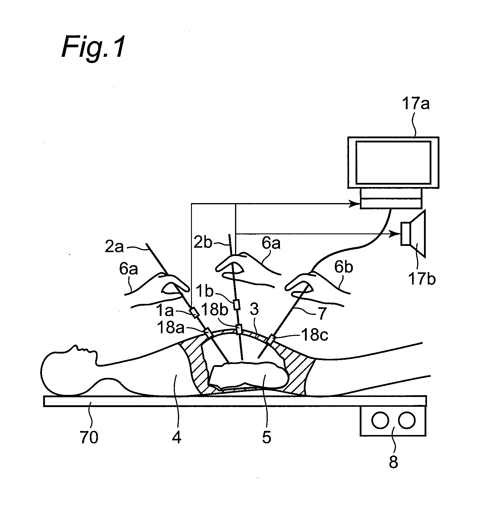 Force measurement apparatus, force measurement method, force measurement program, force measurement integrated electronic circuit, and master-slave device