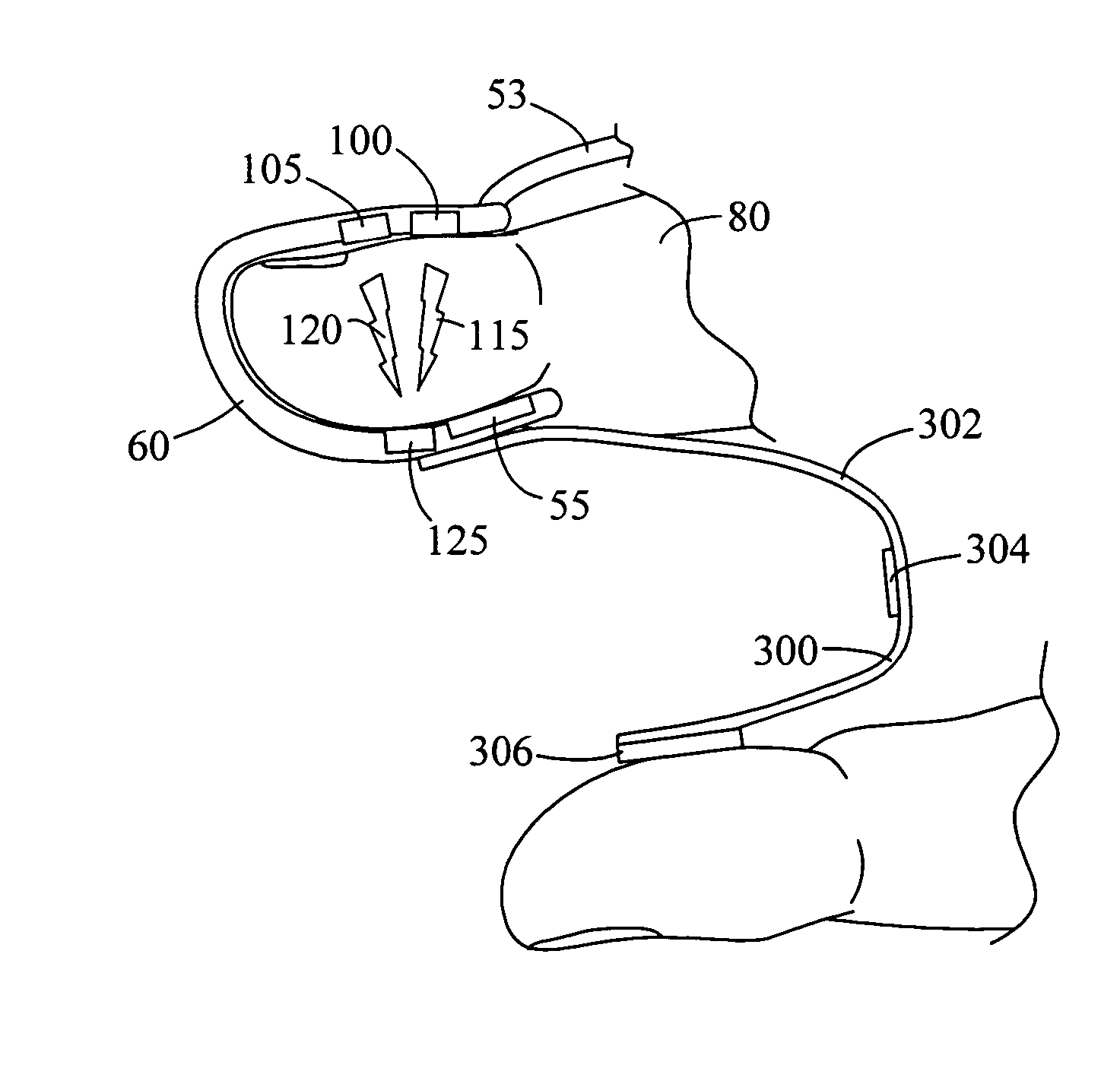 Apparatus and method for acquiring oximetry and electrocardiogram signals