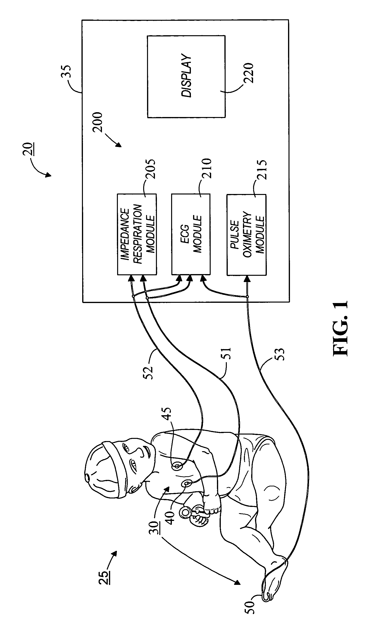 Apparatus and method for acquiring oximetry and electrocardiogram signals