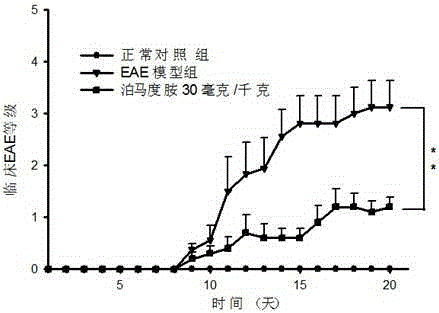 Application of pomalidomide to preparation of medicine for relieving multiple sclerosis