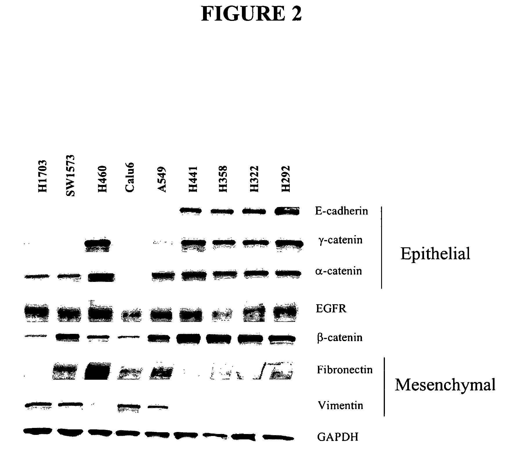 Biological markers predictive of anti-cancer response to insulin-like growth factor-1 receptor kinase inhibitors