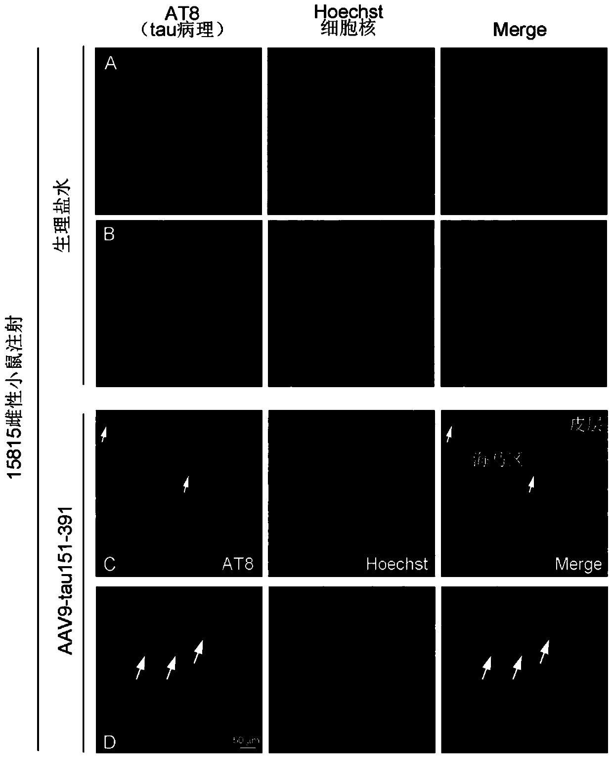 Method for constructing Alzheimer disease mouse model