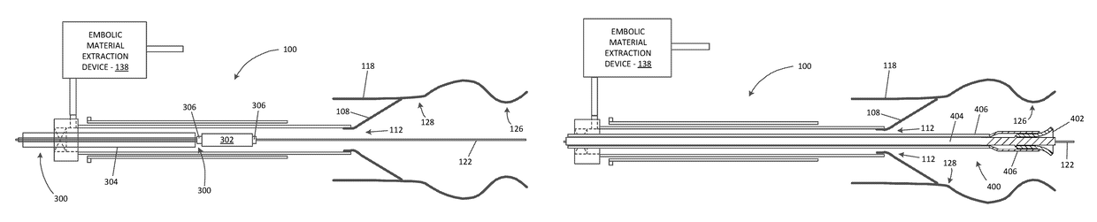 Valve replacement devices