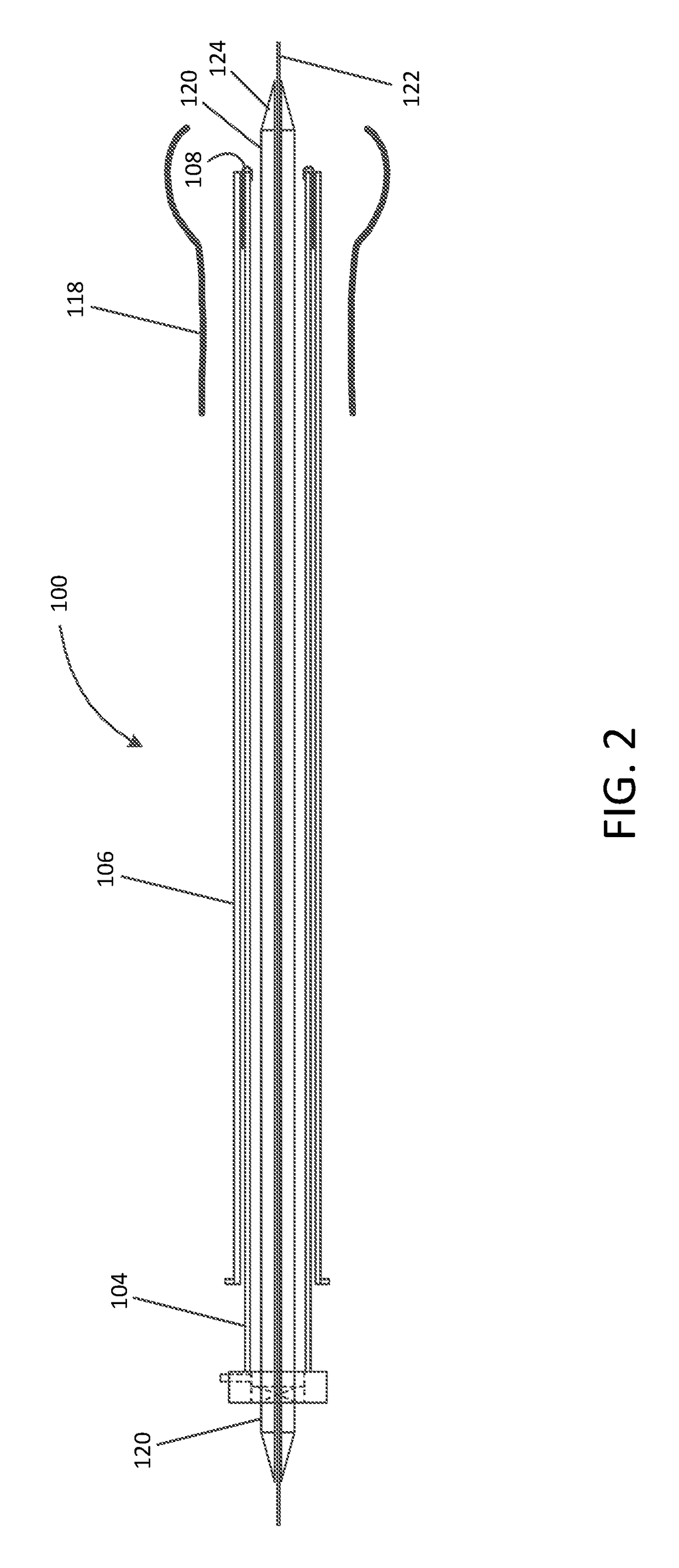 Valve replacement devices