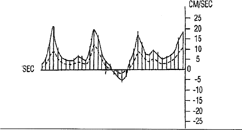 Method and device for regulating measuring range of movement velocity based on spectral Doppler