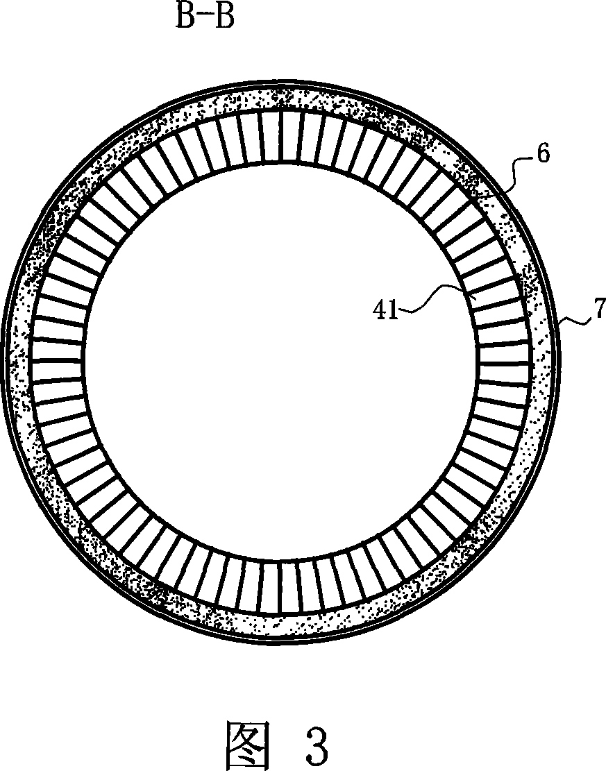 Inner lining structure for torpedo pot and aluminium carbonize silicon carbide brick and high aluminium brick used for torpedo pot