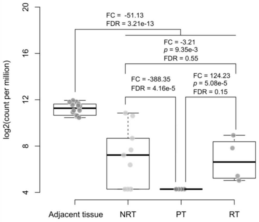 CircGLS2 and application thereof in diagnosis, treatment and prognosis of liver cancer