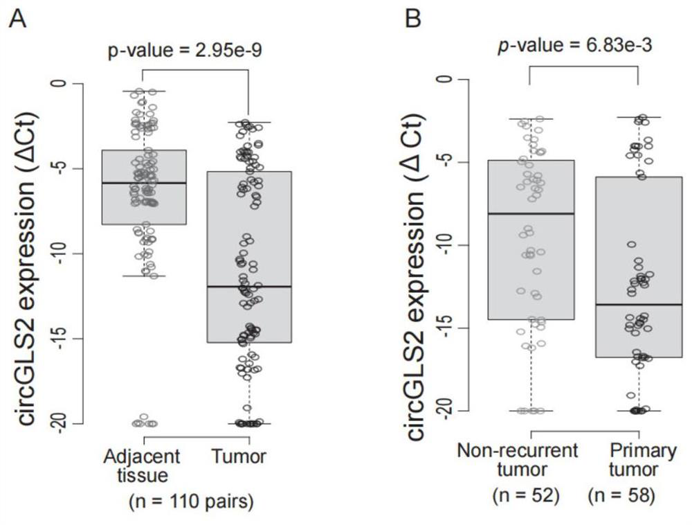 CircGLS2 and application thereof in diagnosis, treatment and prognosis of liver cancer