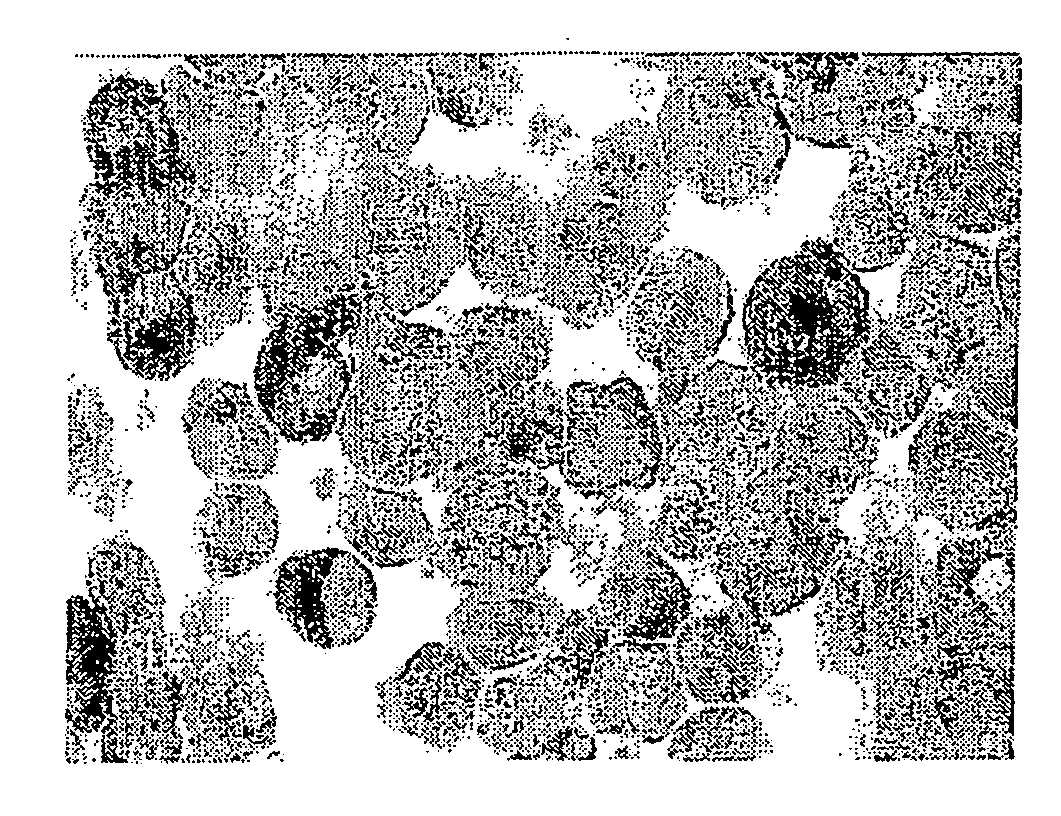 Method for the identification of extracellular domains of Epstein Barr Virus (EBV) tumor-associated latent membrane proteins and for the selection of antibody reagents reactive therewith