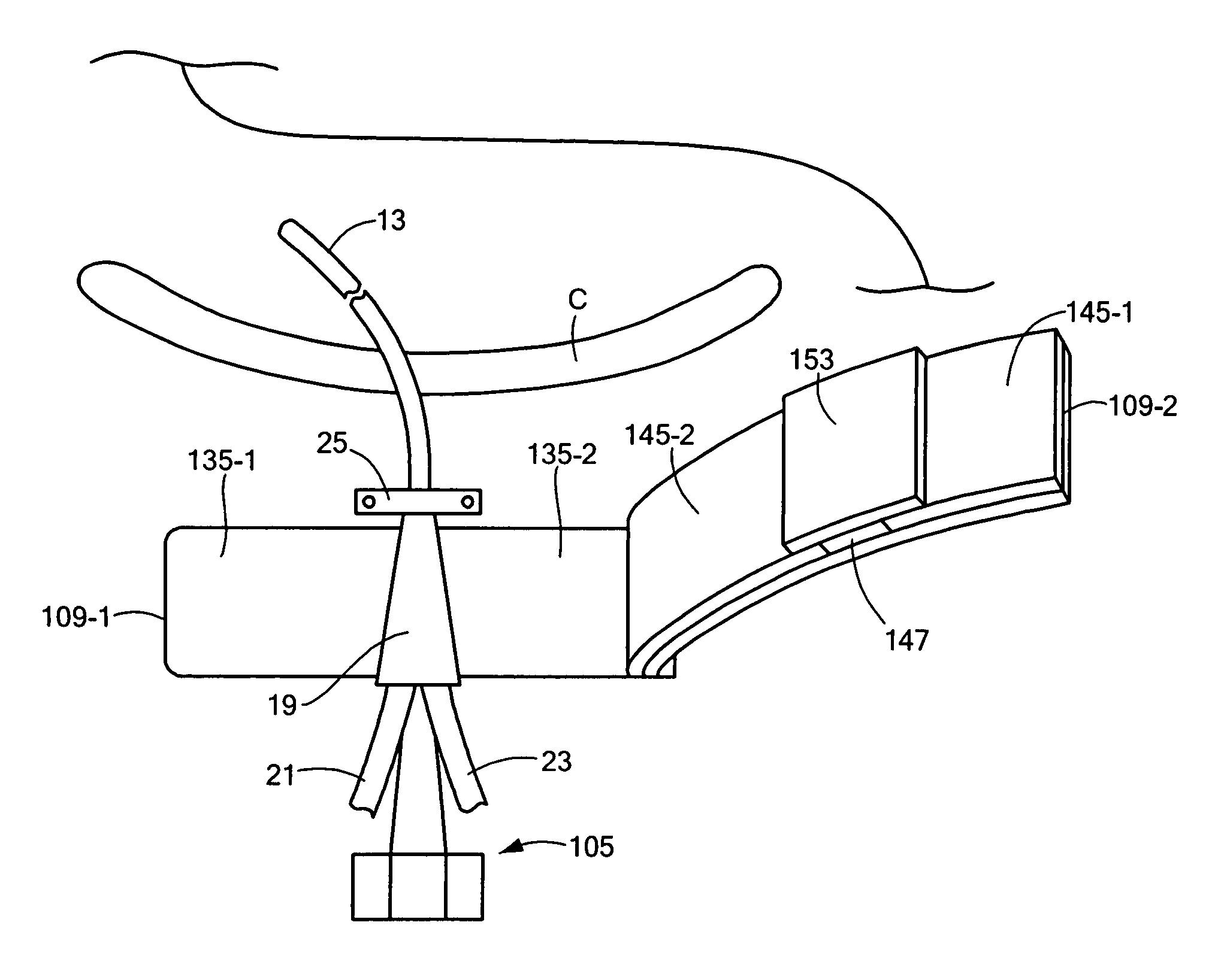 Medical appliance securing device and method of using the same