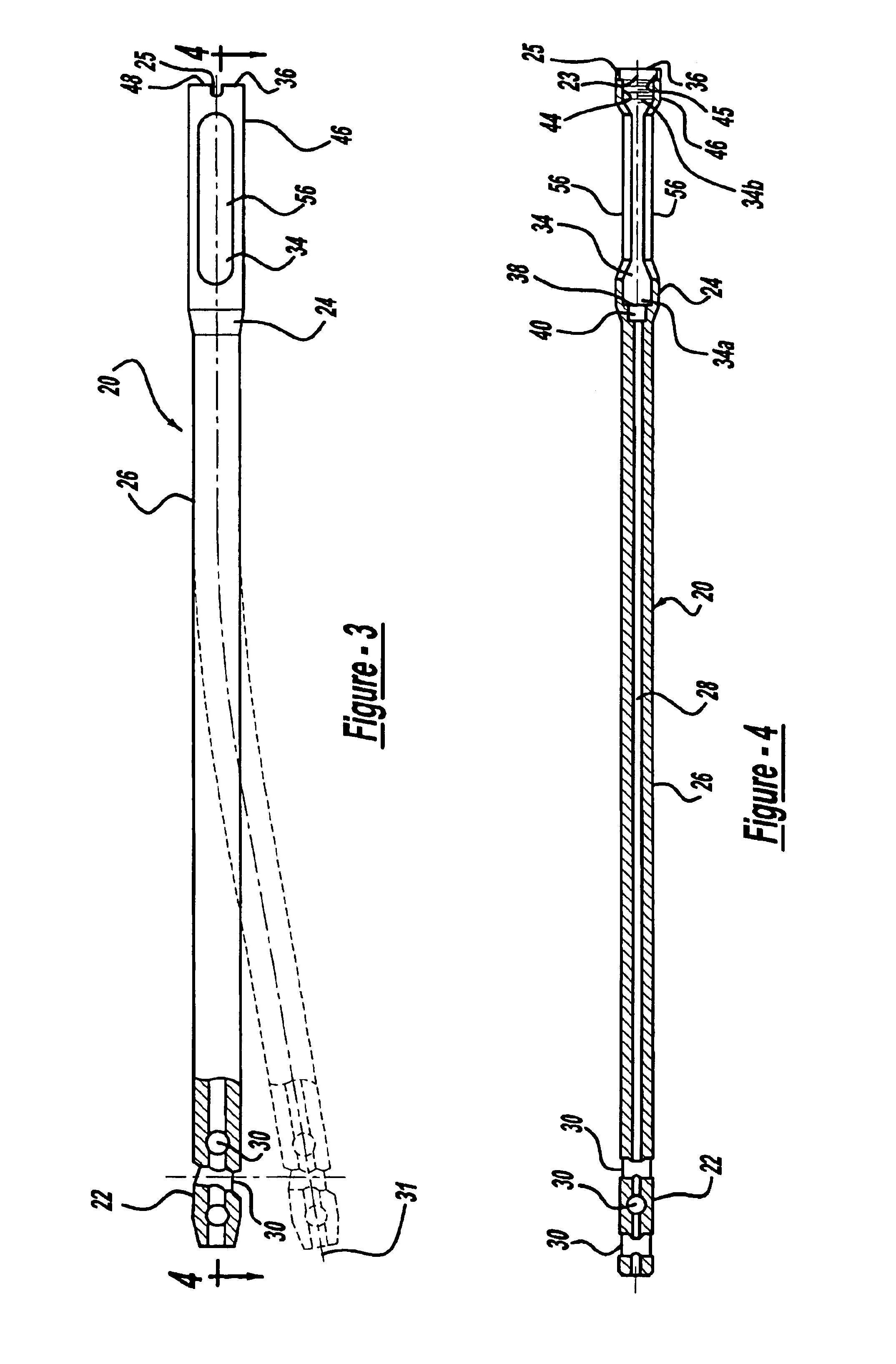 Modular intramedullary nail