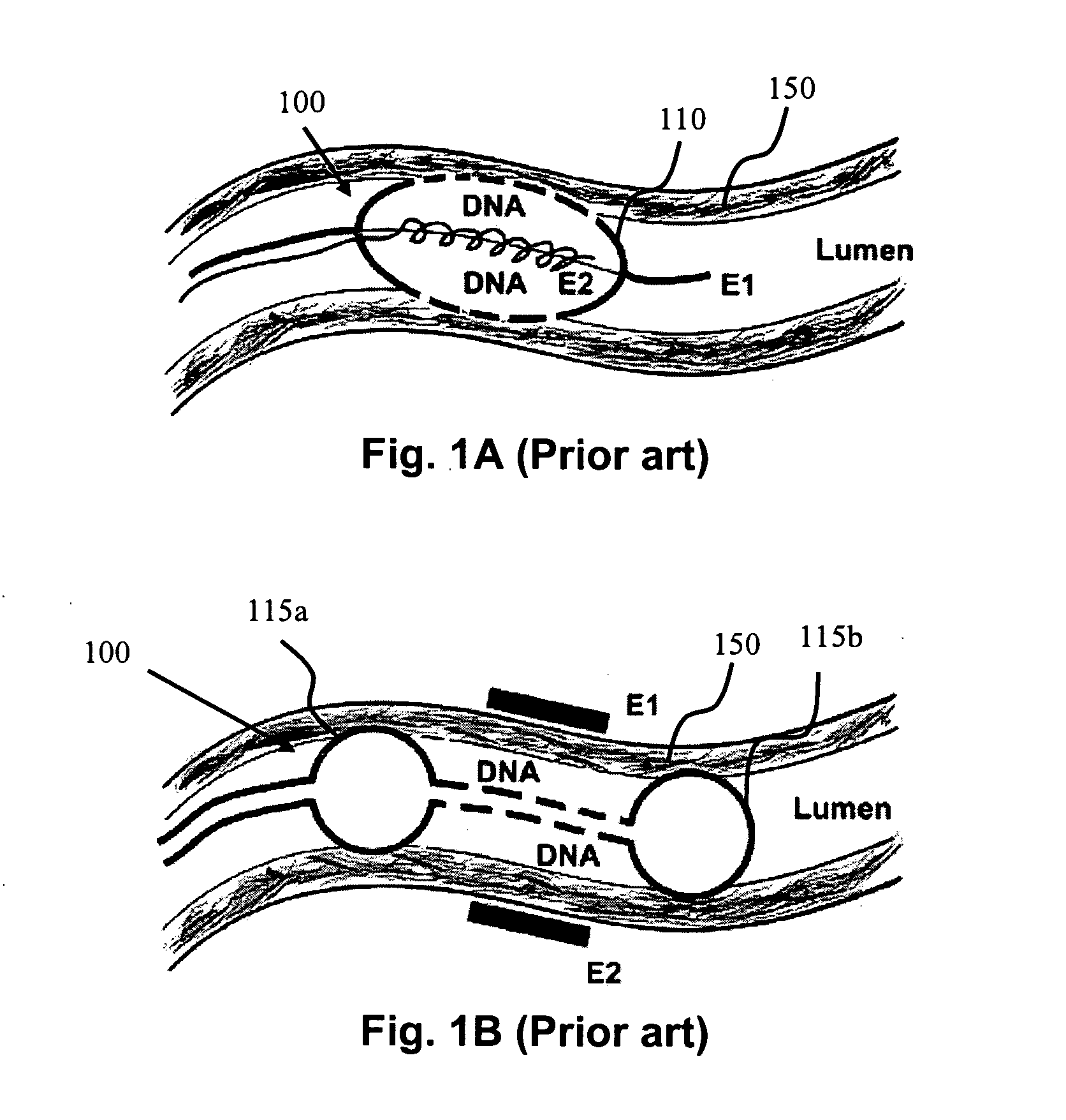Internal medical devices for delivery of therapeutic agent in conjunction with a source of electrical power