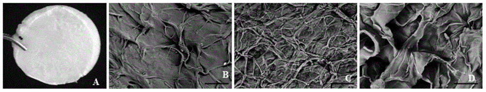 Composite Tbeta4 collagen-chitosan tissue engineering scaffold as well as preparation method and application thereof