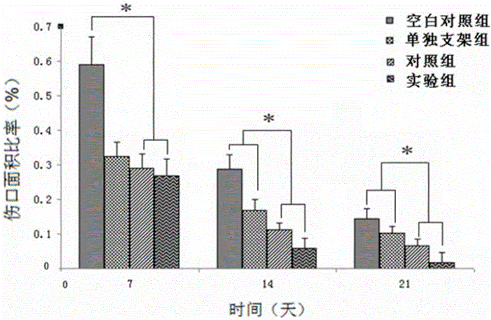 Composite Tbeta4 collagen-chitosan tissue engineering scaffold as well as preparation method and application thereof