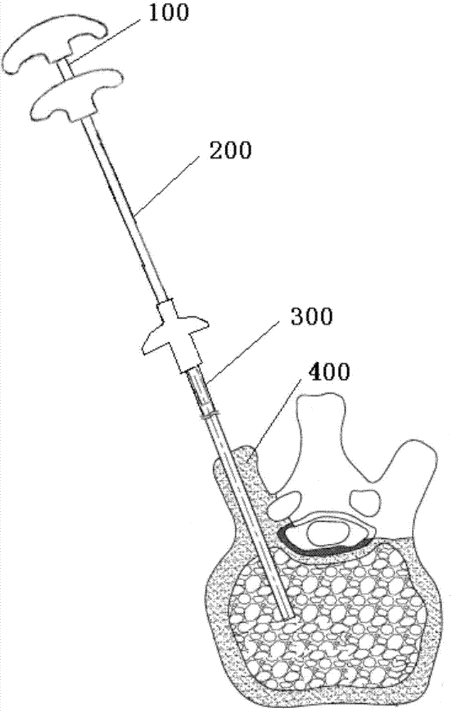 Automatic boosting device and system for injecting bone cement in vertebral plasty