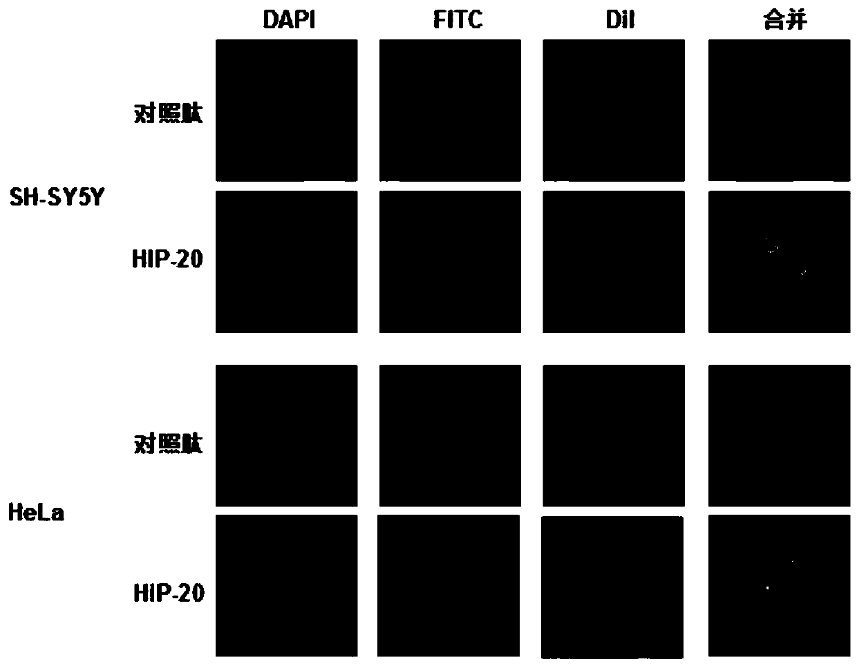 A kind of polypeptide hip-20 that can antagonize the RNA binding activity of hnrnpu protein and its application