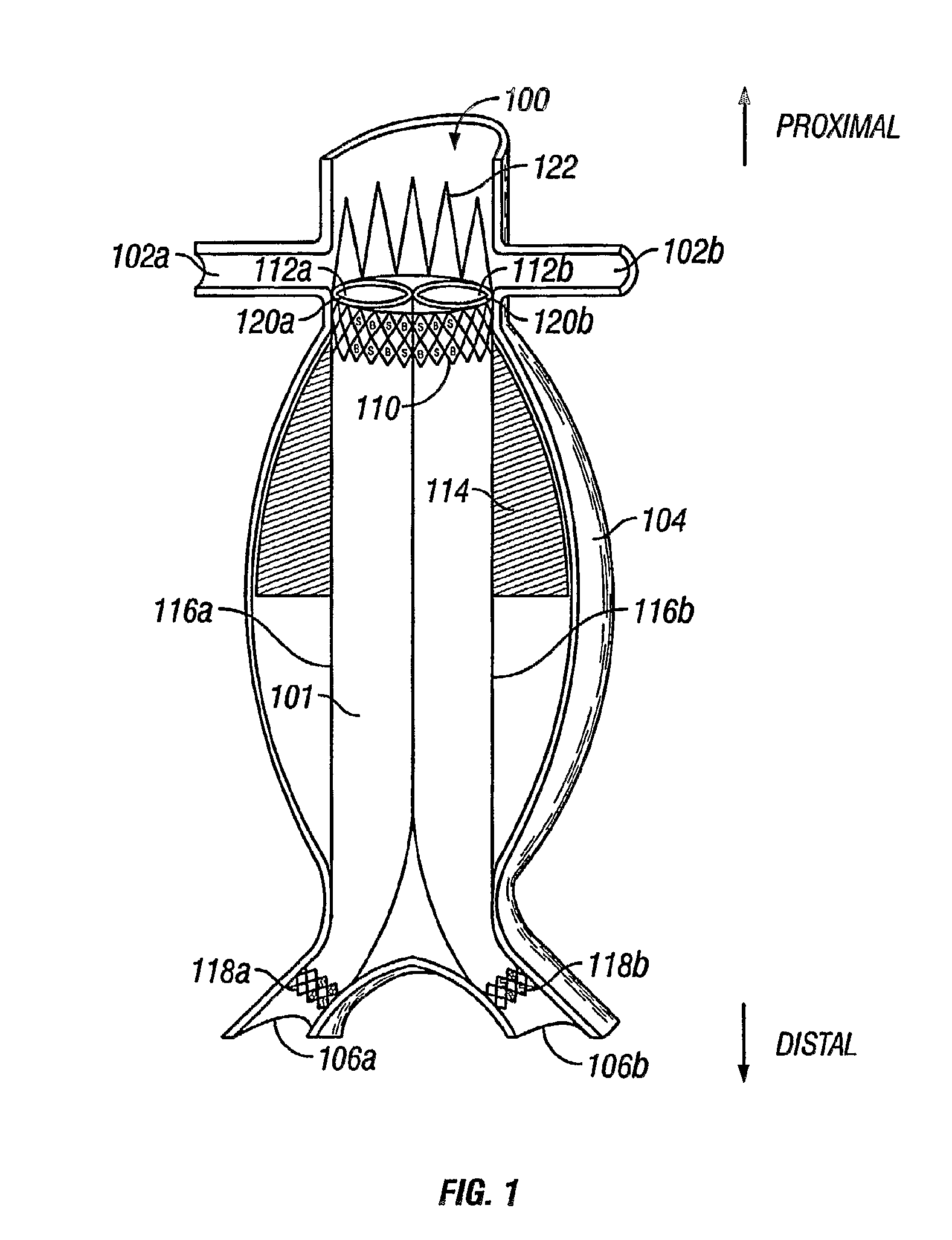 Devices and methods for treatment of abdominal aortic aneurysm