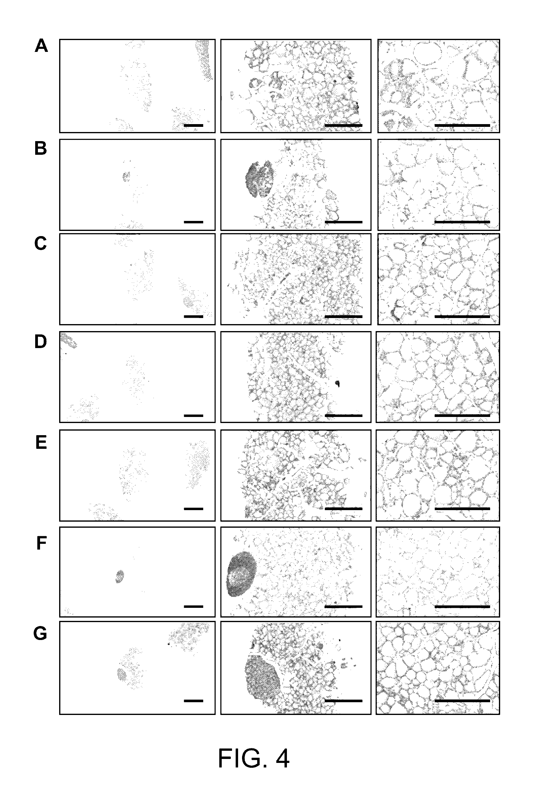 Pharmaceutical composition for preventing or treating thyroid diseases, comprising extract from <i>Lonicera caerulea </i>L. var. edulis fruits as active ingredient