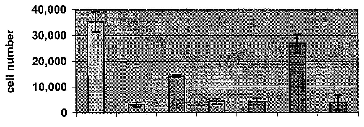 Treatment of peripheral vascular disease using umbilical cord tissue-derived cells