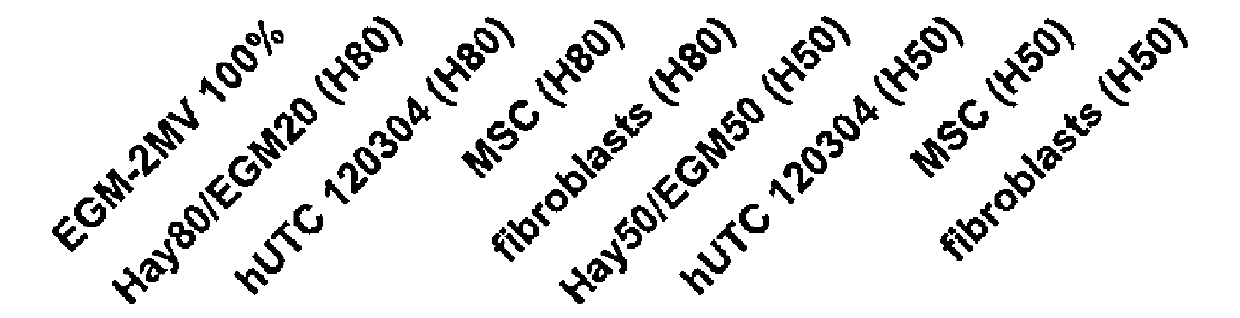 Treatment of peripheral vascular disease using umbilical cord tissue-derived cells