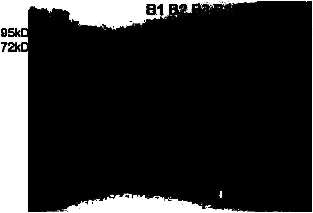 Nucleic acid sequence for coding human choline acetyl transferase or fusion protein of human choline acetyl transferase and application of nucleic acid sequence