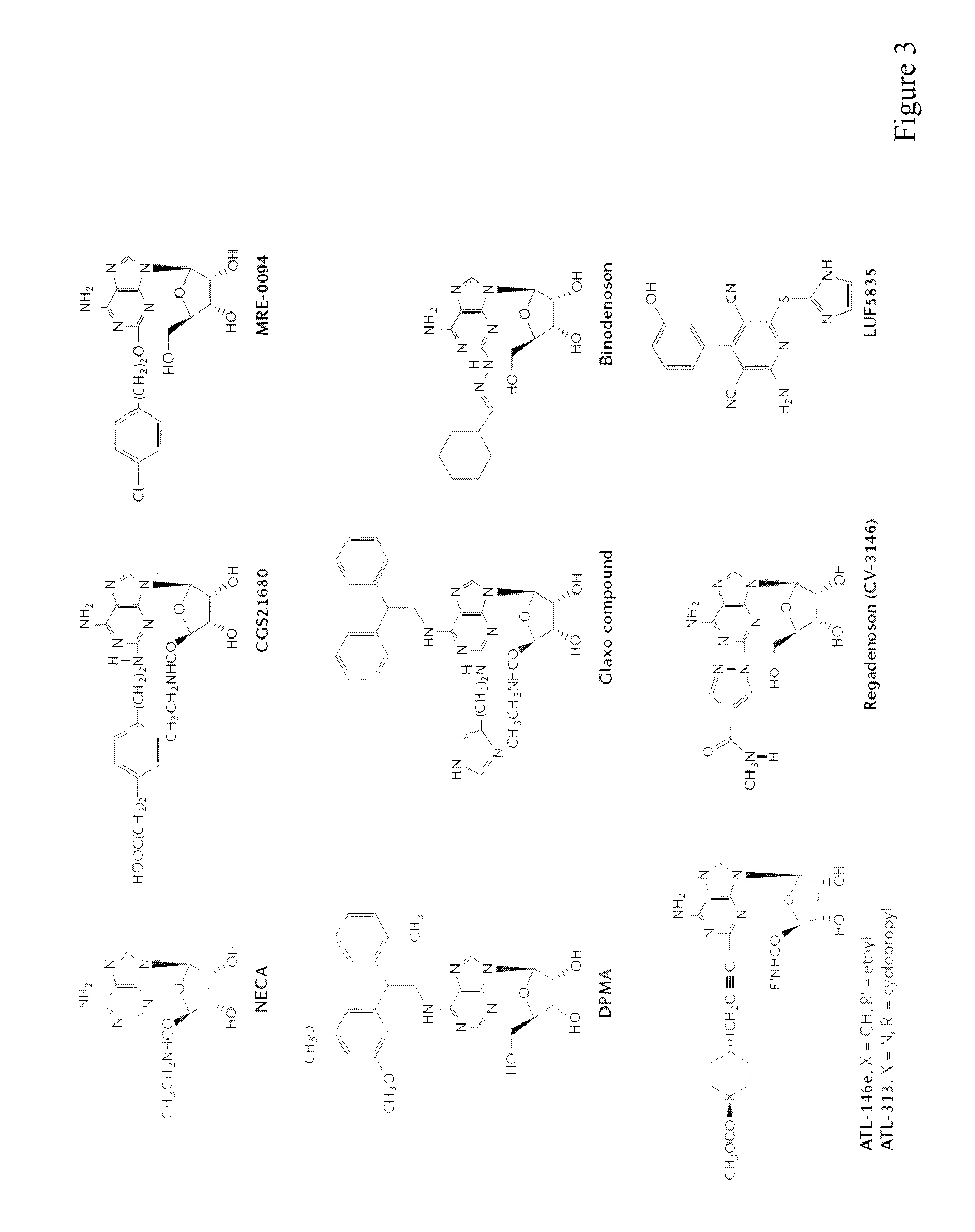 Method of preparing adenosine-resistant Anti-tumor t lymphocytes for adoptive immunotherapy