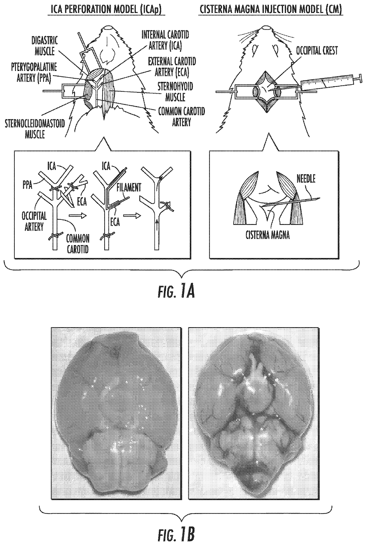 Compositions and methods for treating cerebral vasospasm