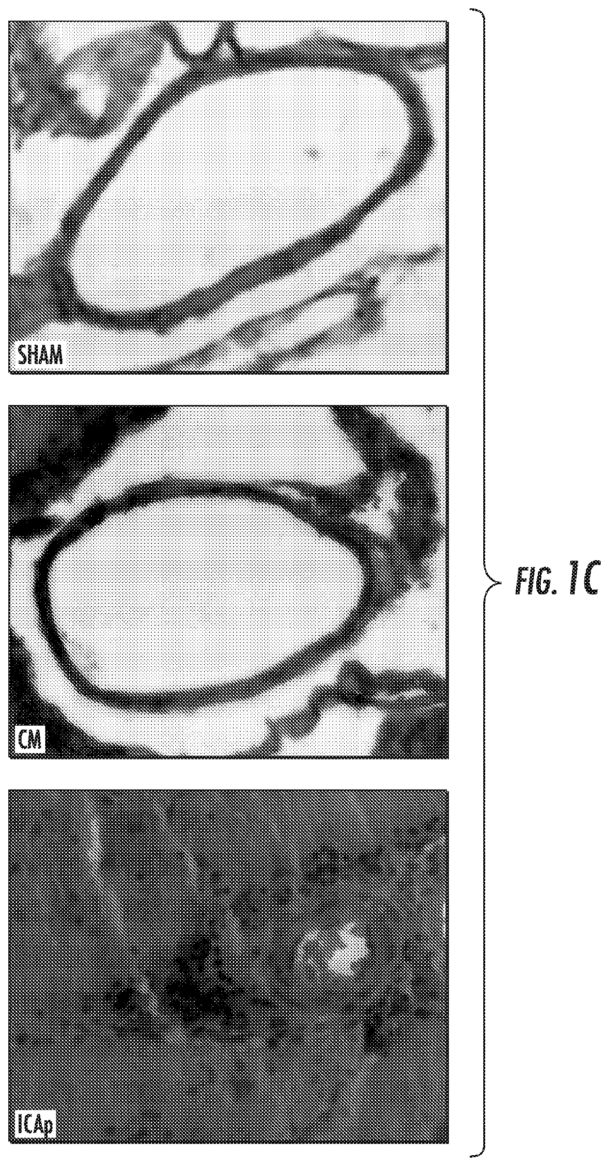 Compositions and methods for treating cerebral vasospasm