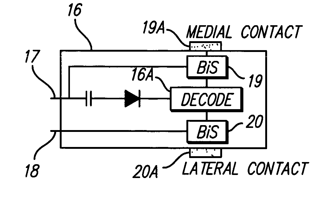 High contact count, sub-miniature, full implantable cochlear prosthesis