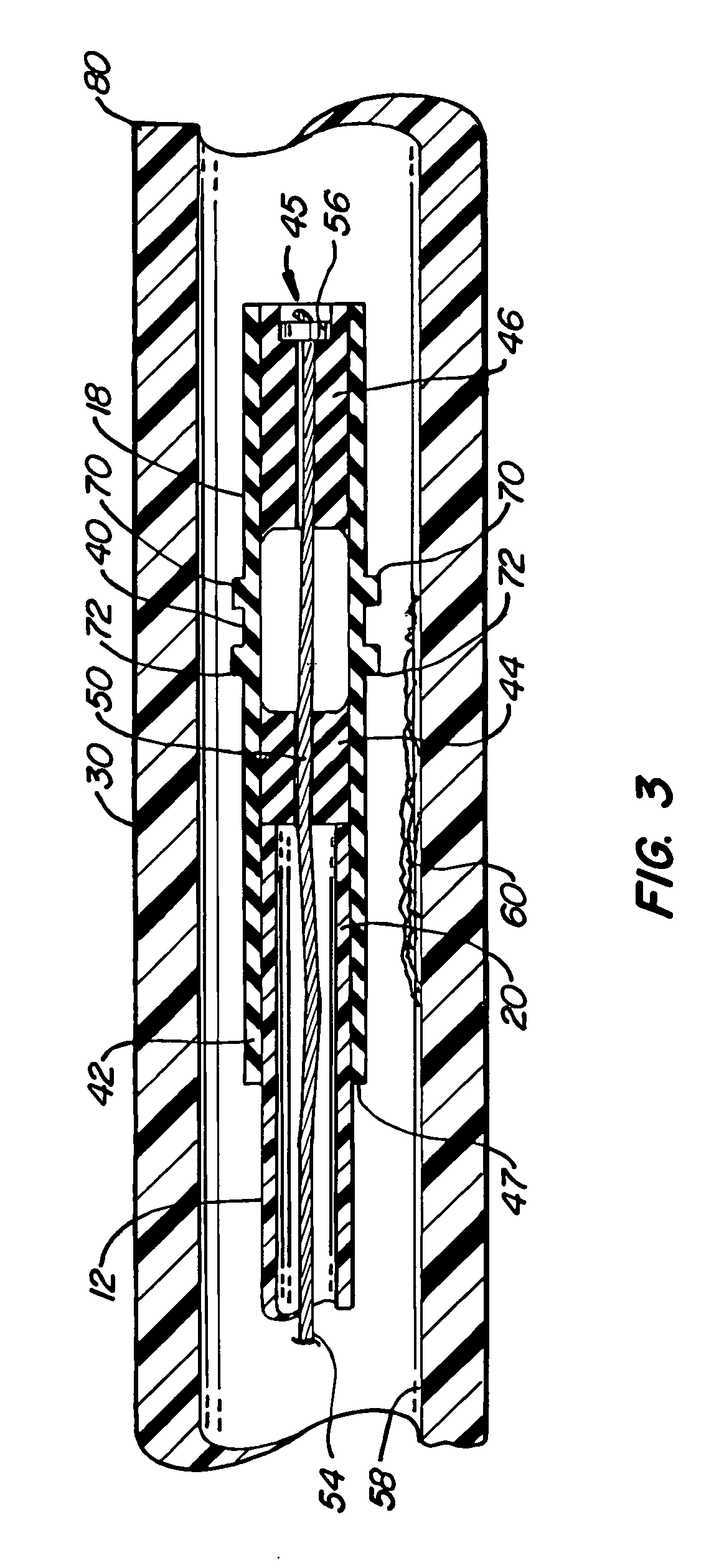 Mucus shaving apparatus for endotracheal tubes