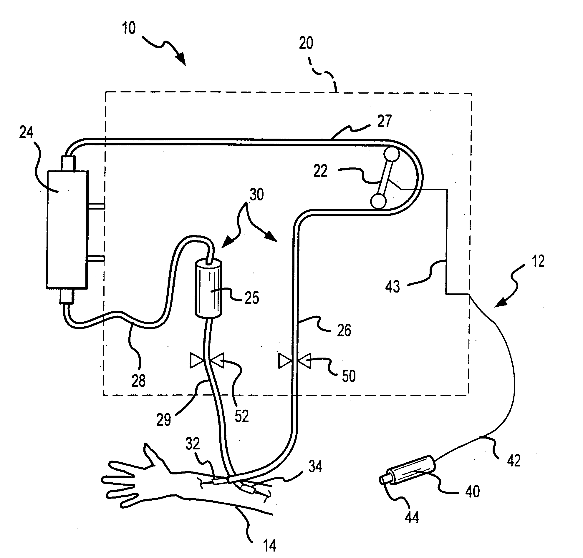 Remote control for extracorporeal blood processing machines