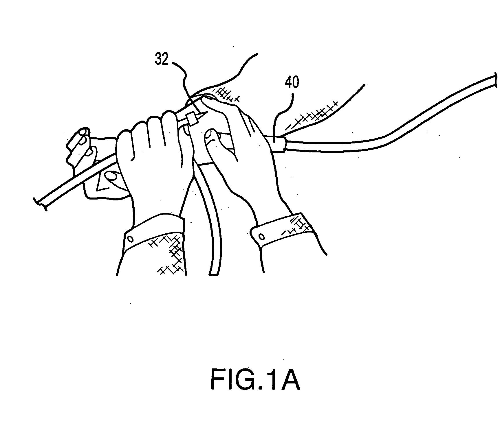 Remote control for extracorporeal blood processing machines