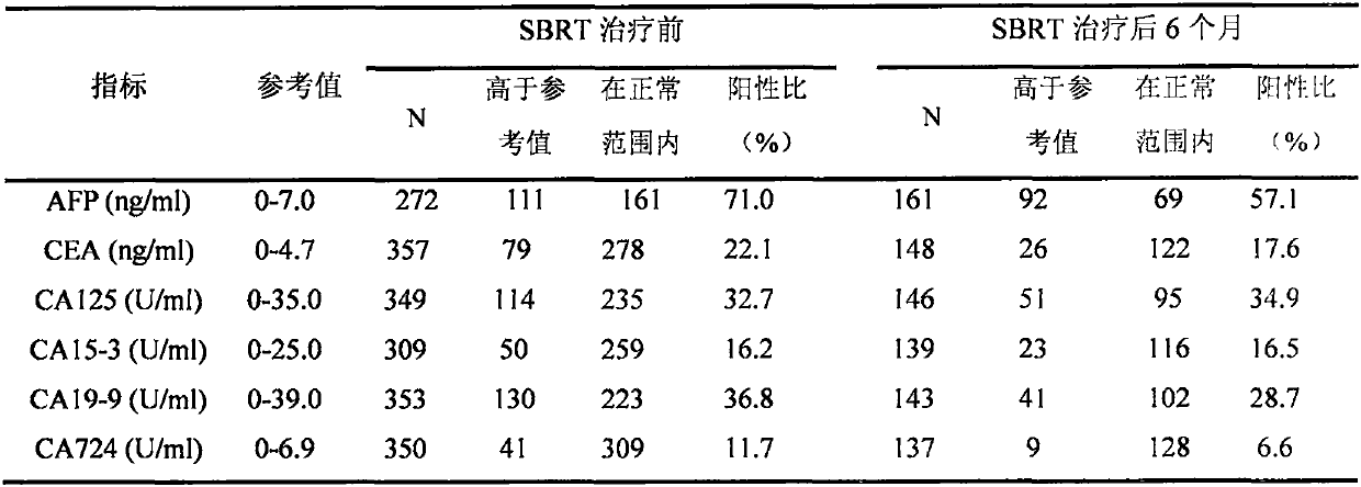 Application of CA125 to curative effect evaluation of primary liver cancer stereotactic radiotherapy