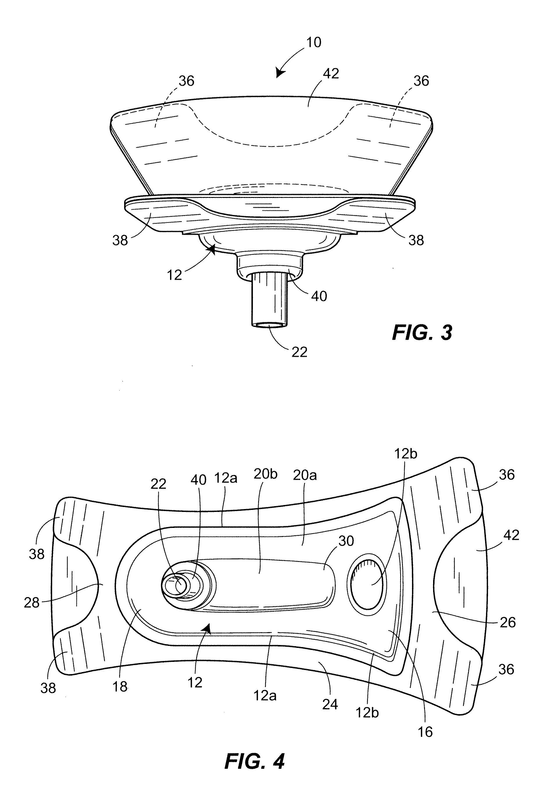 Urinary incontinence device and method