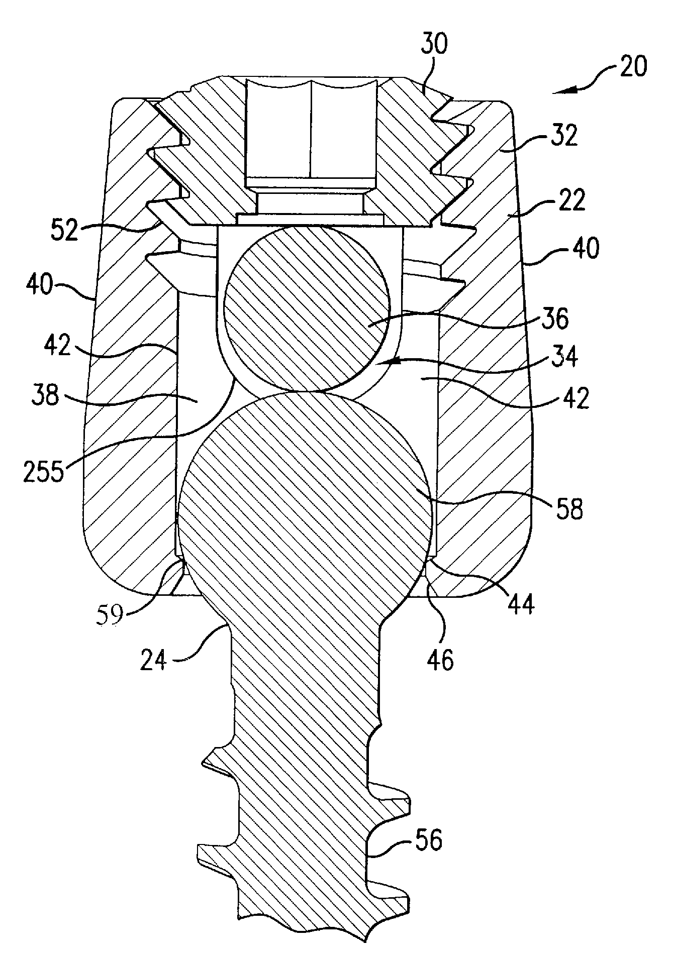 Multi-axial bone attachment assembly