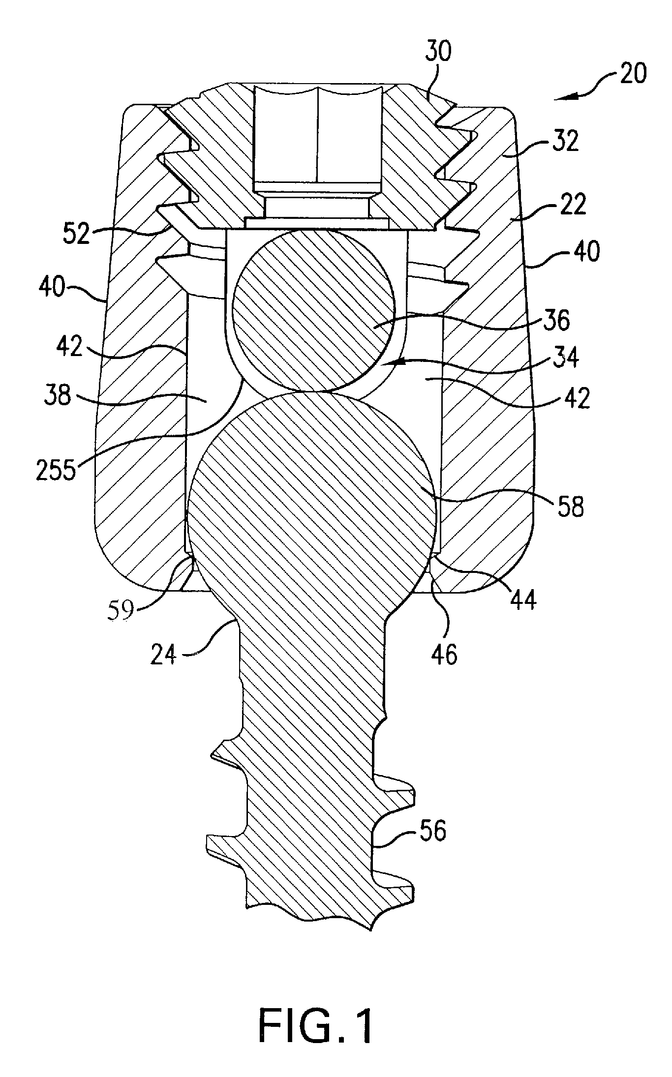 Multi-axial bone attachment assembly