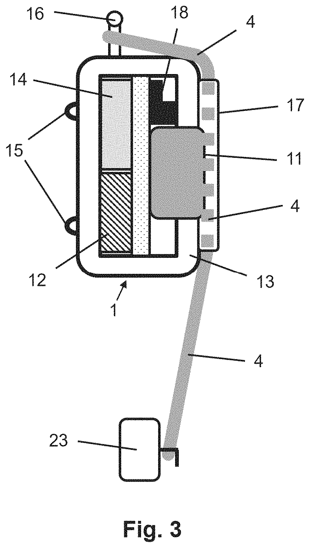 Sensor and system for monitoring the wearing duration of orthodontic elastics