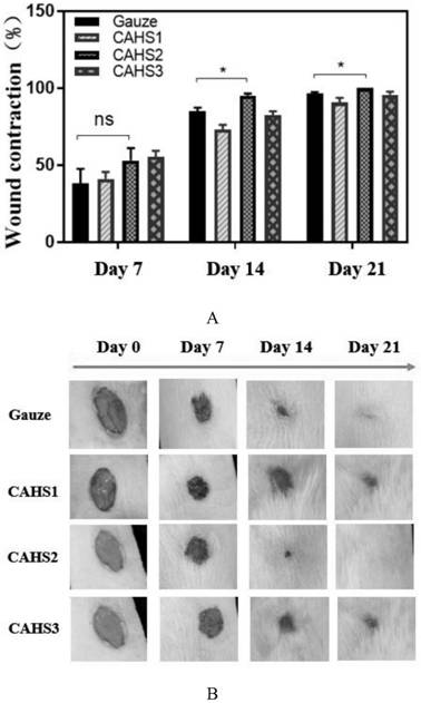 Chitosan-based polyelectrolyte composite hemostatic sponge, preparation method and application