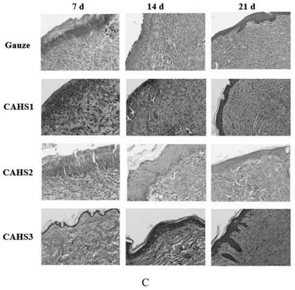 Chitosan-based polyelectrolyte composite hemostatic sponge, preparation method and application