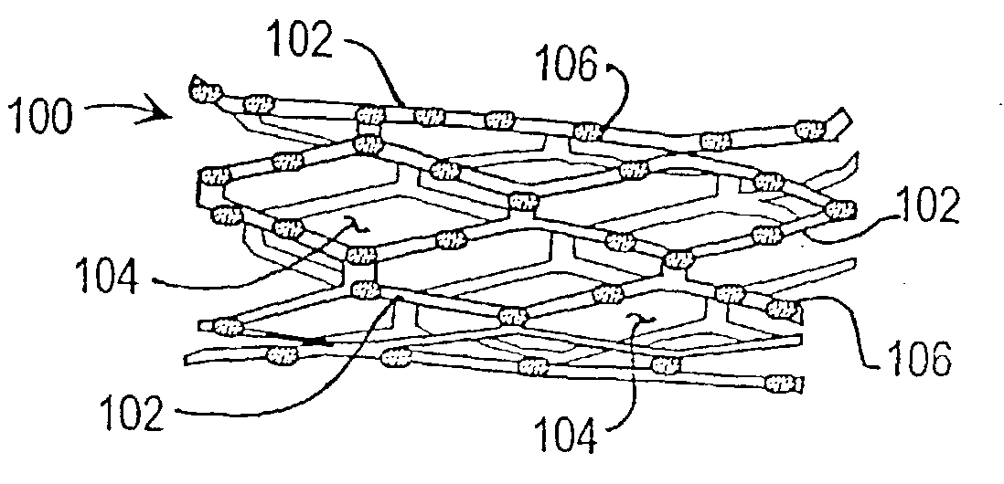 Inhibition of restenosis using a DNA-coated stent