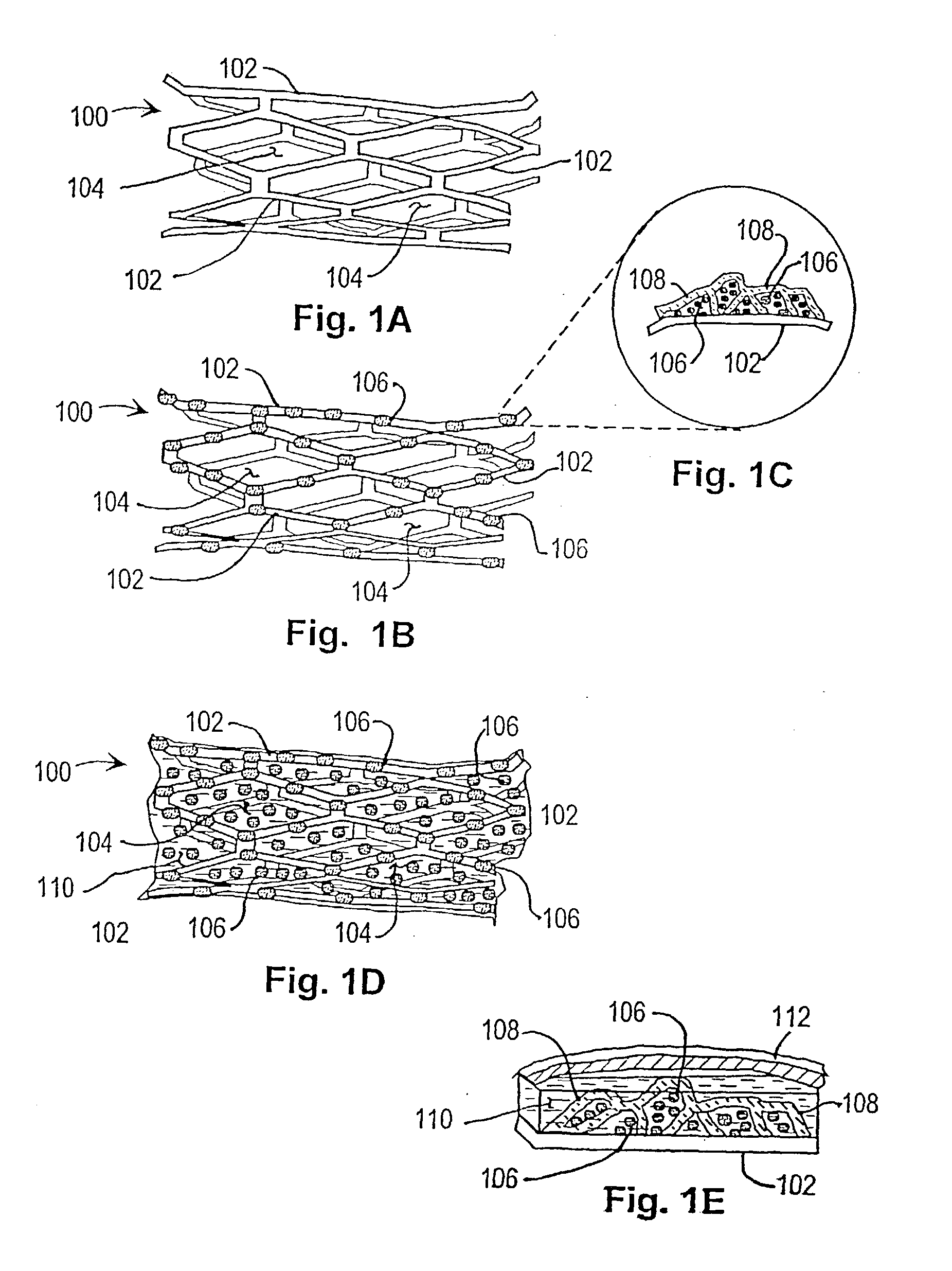 Inhibition of restenosis using a DNA-coated stent